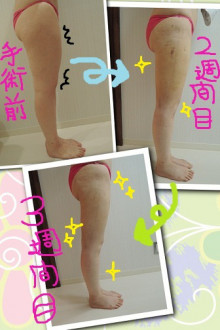 A�q�̎��b�z���̌����L�����̐X���e�O�ȁi���E���É��E�k�C���j