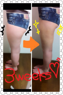 A�q�̎��b�z���̌����L�����̐X���e�O�ȁi���E���É��E�k�C���j