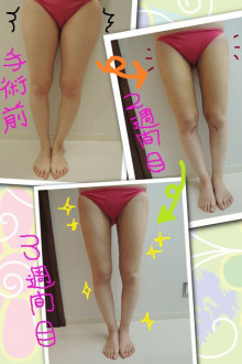 A�q�̎��b�z���̌����L�����̐X���e�O�ȁi���E���É��E�k�C���j